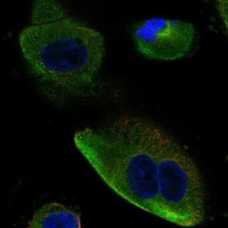 DCDC2 Antibody, Novus Biologicals 0.1mL; Unlabeled:Antibodies, Polyclonal